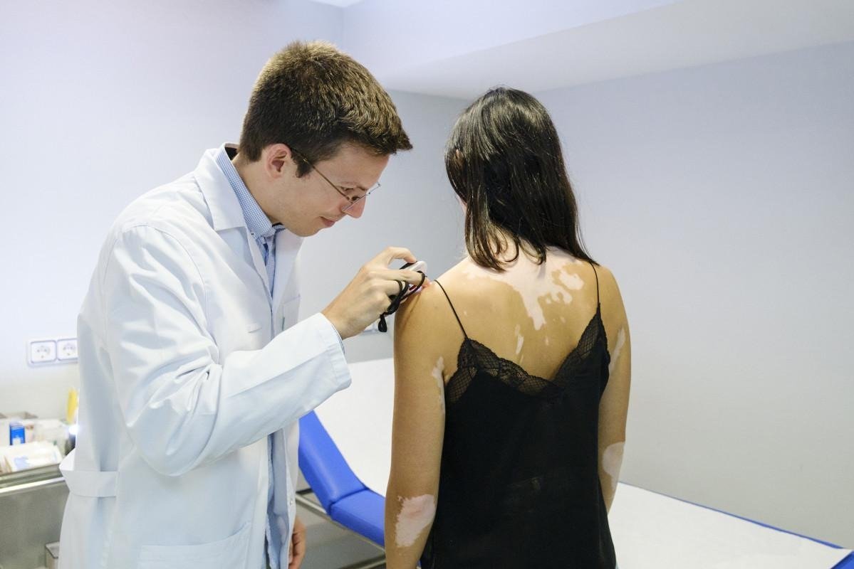 Monobenzone Depigmentation Cream: A Specialized Treatment for Extensive Vitiligo